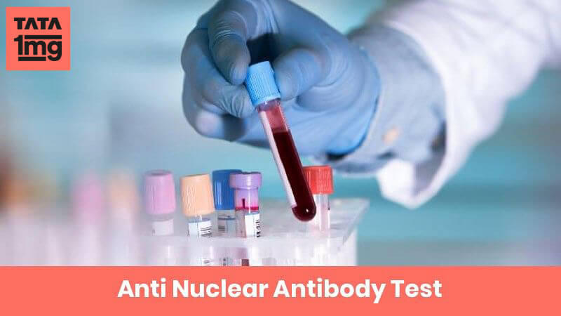 Anti Nuclear Antibody